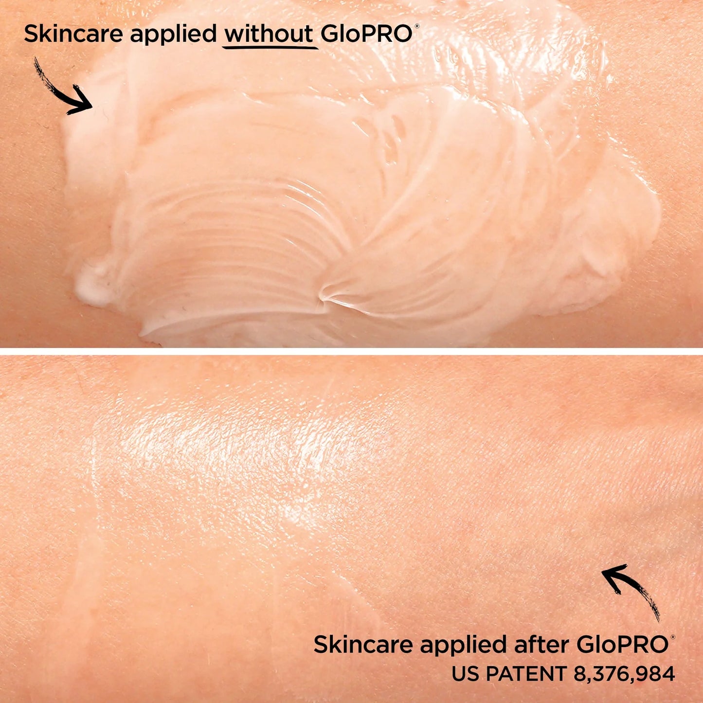 Before and after comparison of skincare application with GloPRO technology.