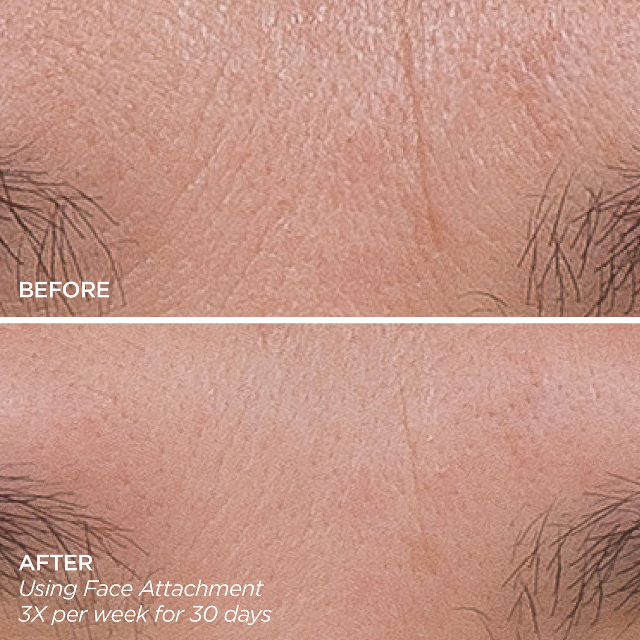 Before and after comparison of skin texture with text indicating product usage.