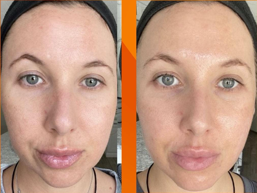 Nu Skin LumiSpa Rose Gold Beauty Device and Collagen Kit