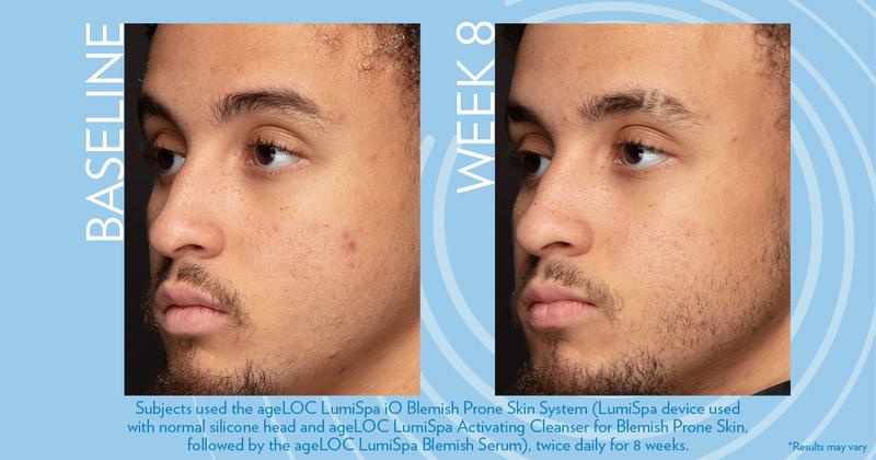 ageLOC LumiSpa Blemish Serum