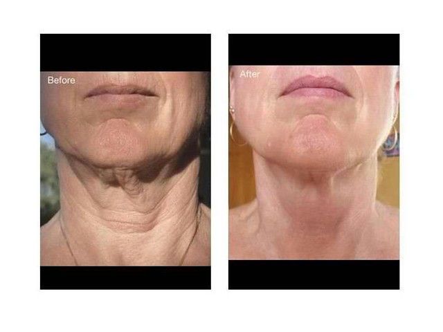 Nu Skin ageLOC Galvanic Face Spa
