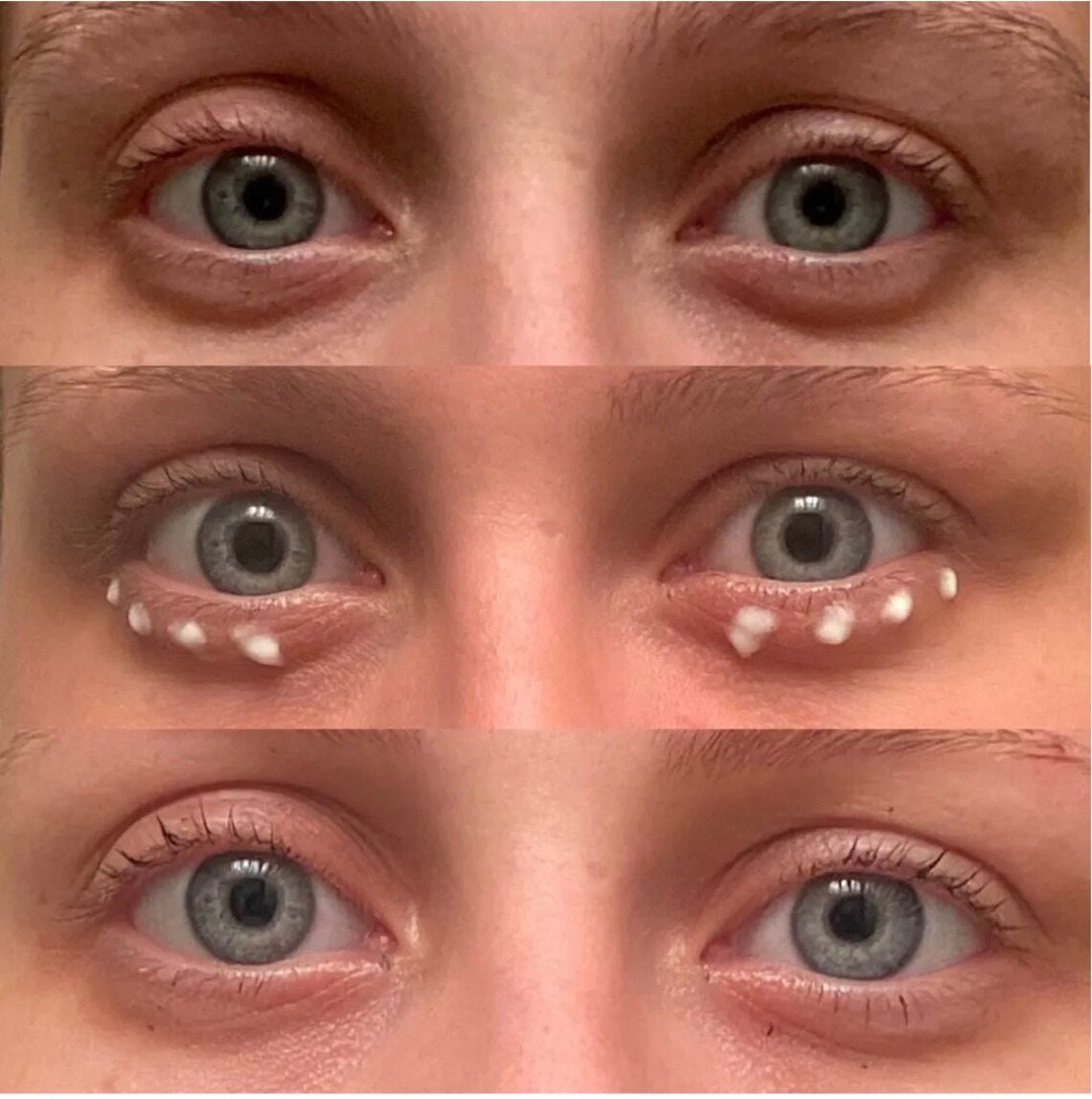 ageLOC LumiSpa iO Rose Gold Accent + IdealEyes Kit