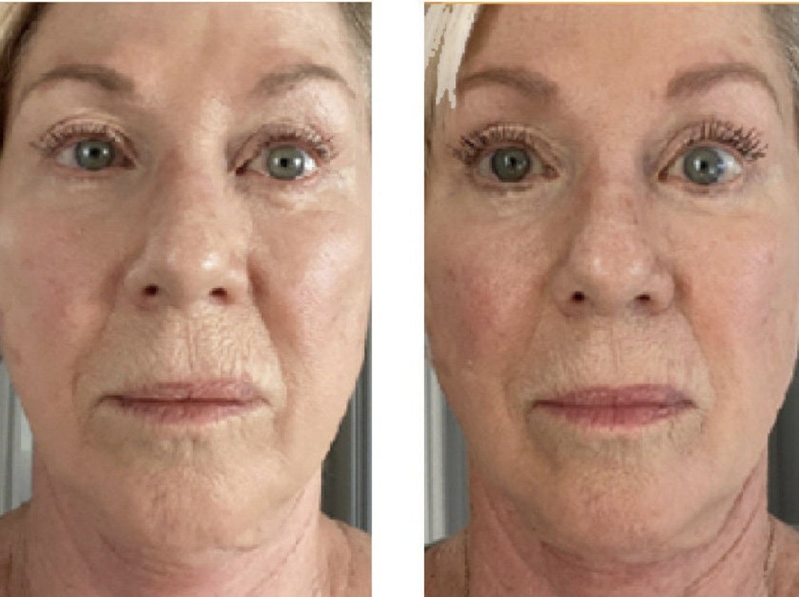 Nu Skin Liquid Collagen+ (Strawberry or Peach) Anti-aging Collagen Supplement