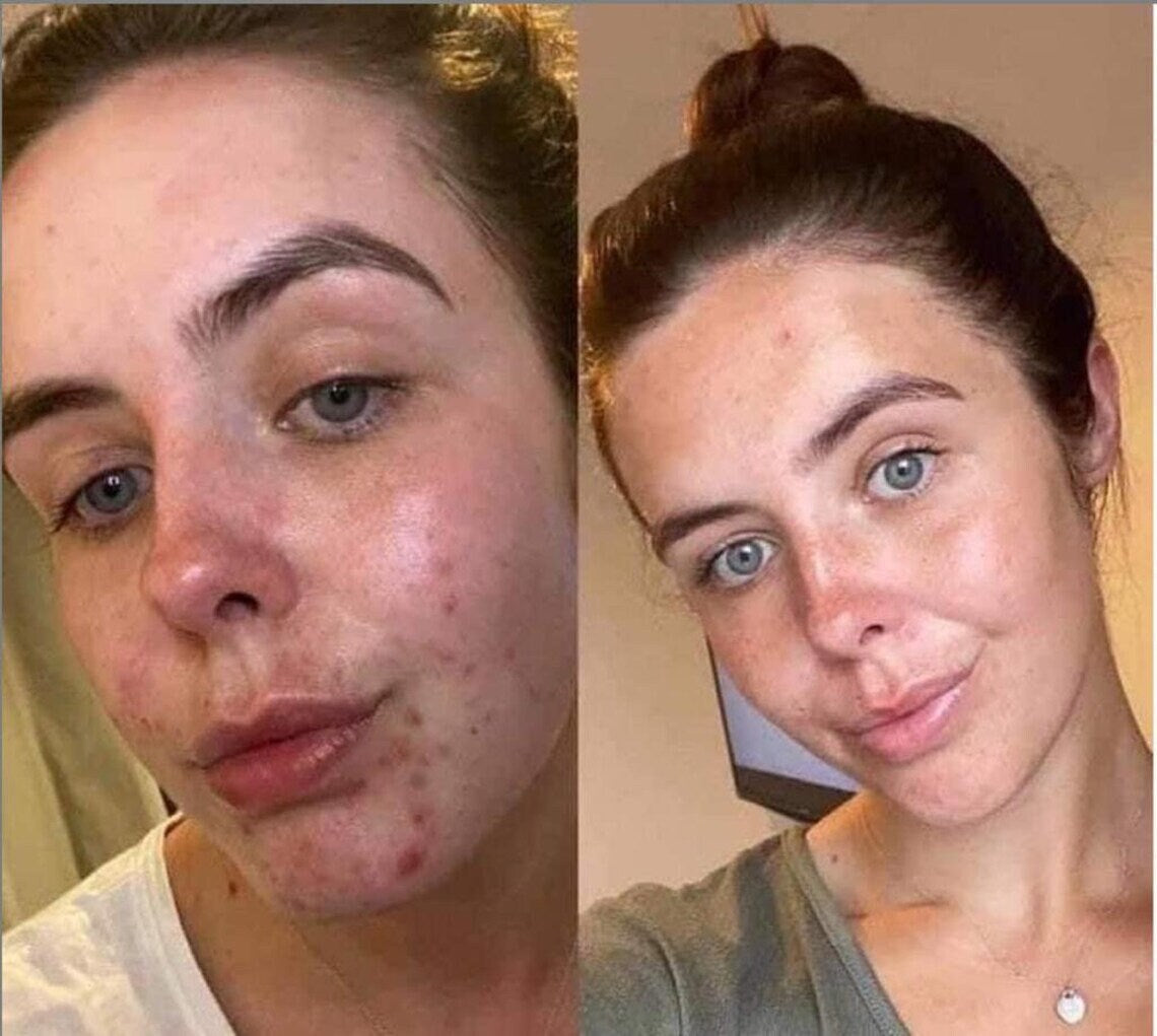 Nu Skin LumiSpa Rose Gold Beauty Device and Collagen Kit