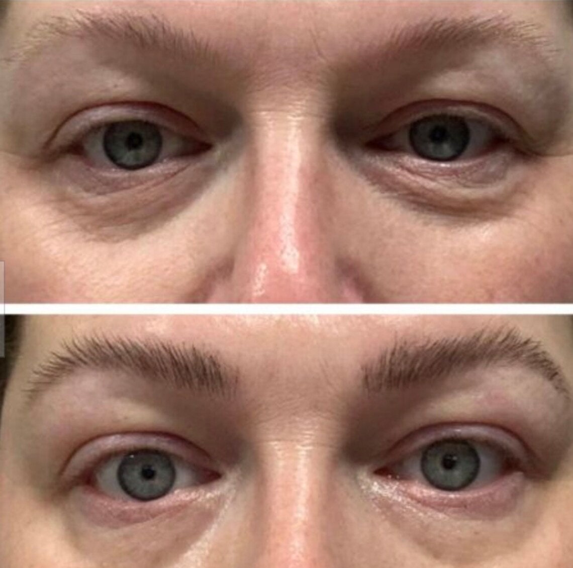 ageLOC LumiSpa iO Rose Gold Accent + IdealEyes Kit