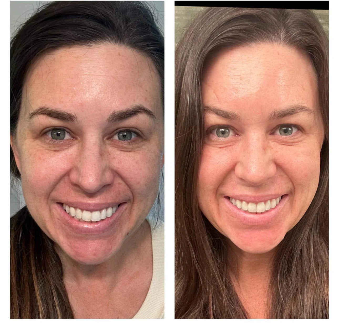Nu Skin Beauty Focus Collagen Plus & Retinol Saver Kit