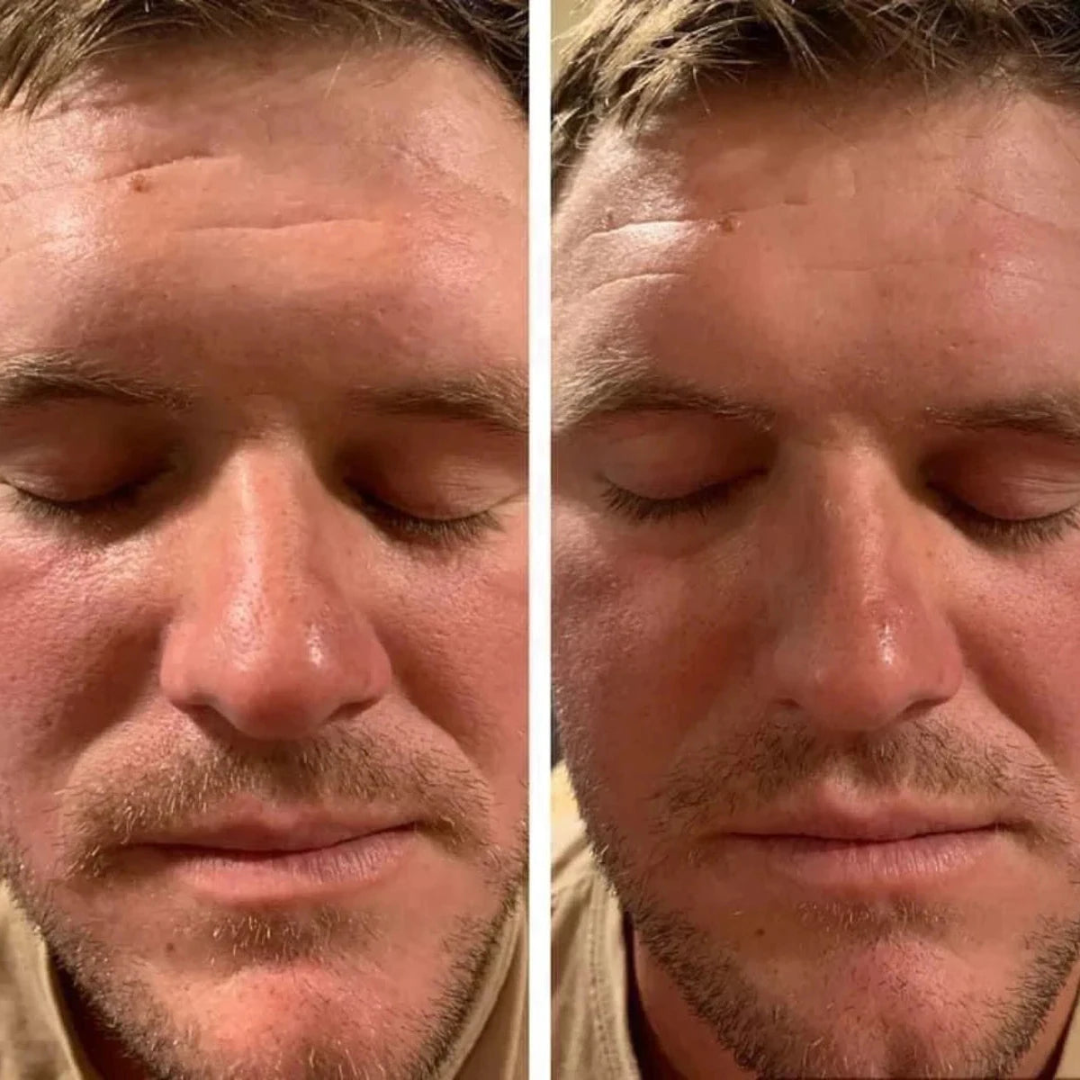 AgeLOC TruFace Line Corrector results