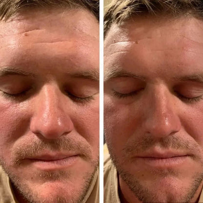 AgeLOC TruFace Line Corrector results