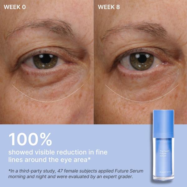 Before and after comparison of eye area with Future Serum bottle shown.
