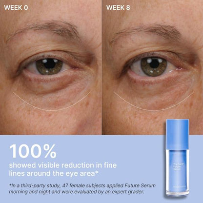 Before and after comparison of eye area with Future Serum bottle shown.