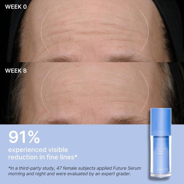 Before and after comparison of fine lines on skin with a bottle of Future Serum.