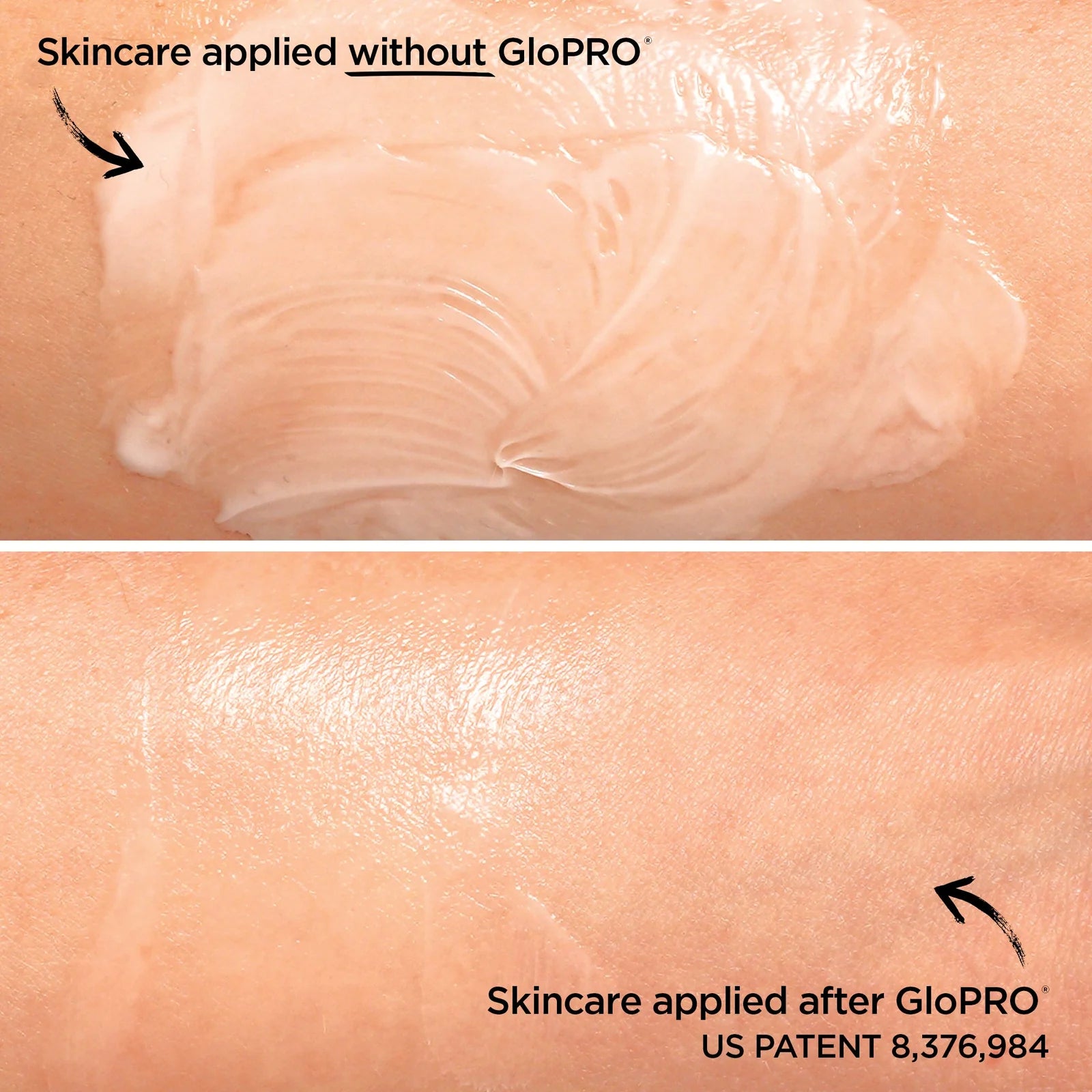 Before and after comparison of skincare application with GloPRO technology.