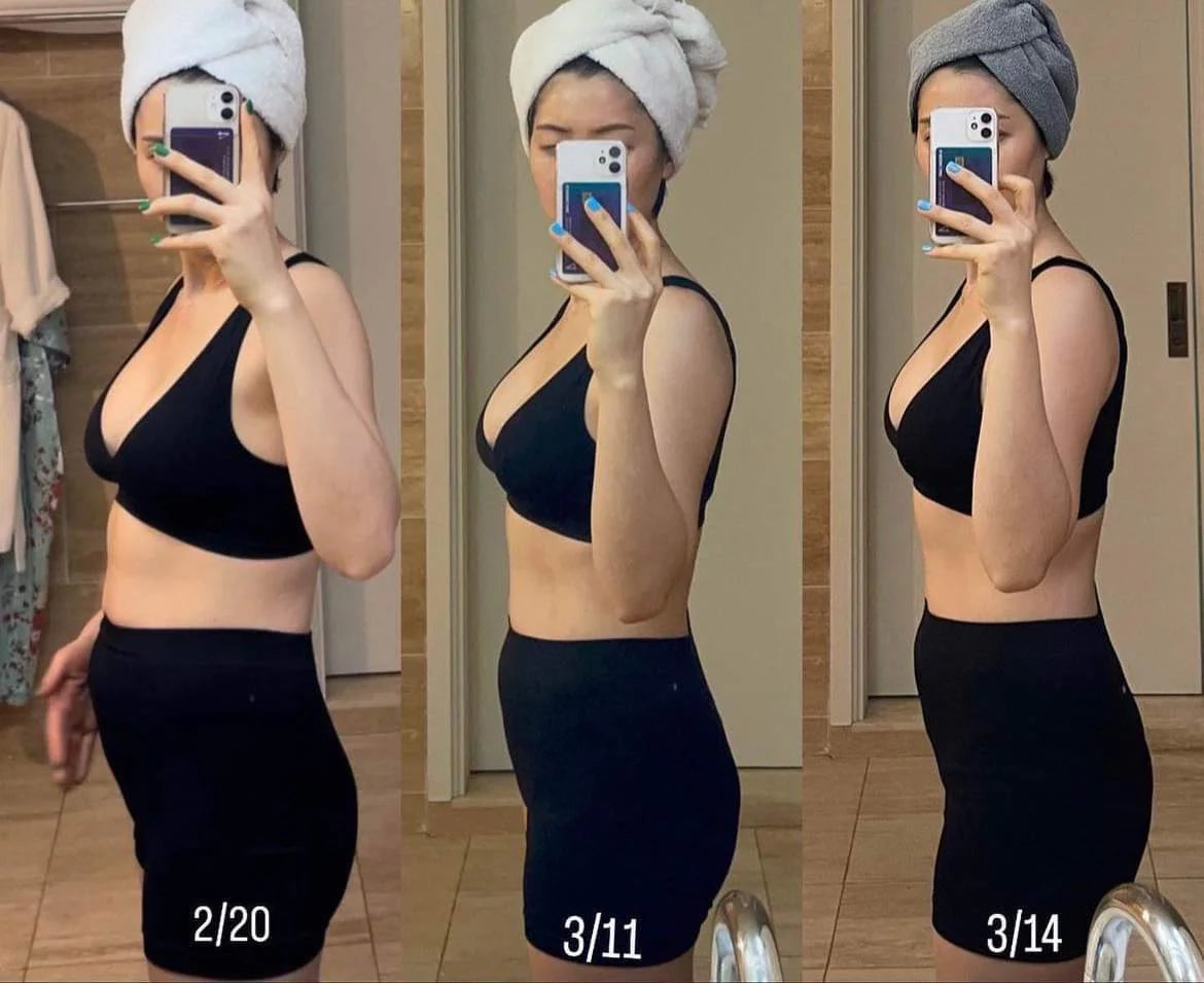 Ibiza beauty Store TRME Results Before And After Review 3 weeks