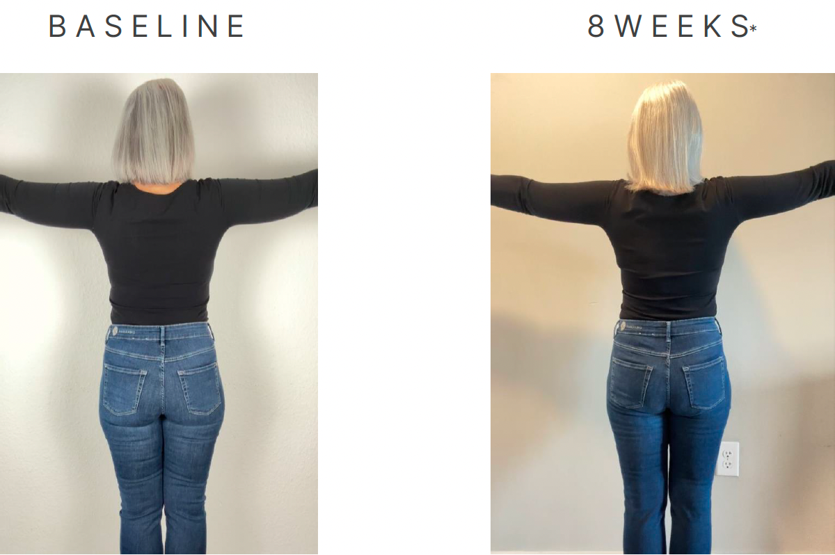 Ibiza beauty Store TRME Results Before And After Review Back View
