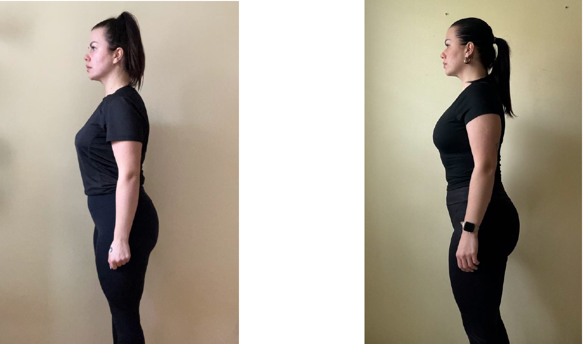 Ibiza beauty Store TRME Results Before And After Review Side View