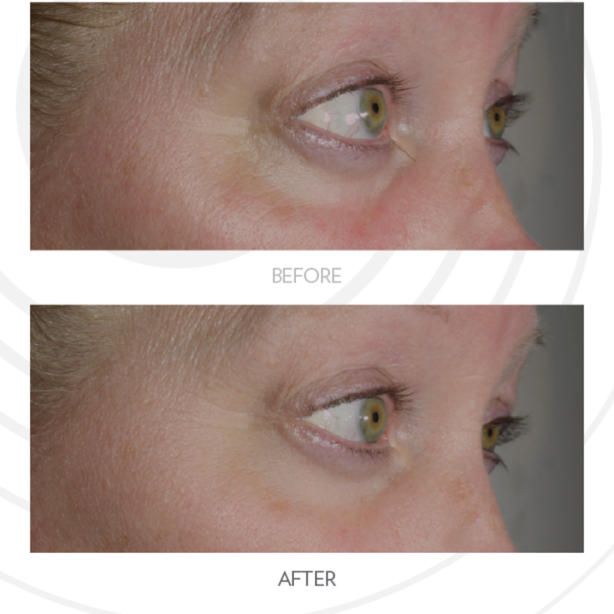 Nu Skin LumiSpa iO & Accent Head Bundle | Valentine's Glow – Ibiza