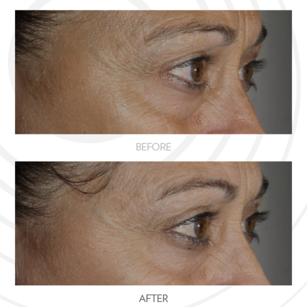 Nu Skin LumiSpa iO & Accent Head Bundle | Valentine's Glow – Ibiza