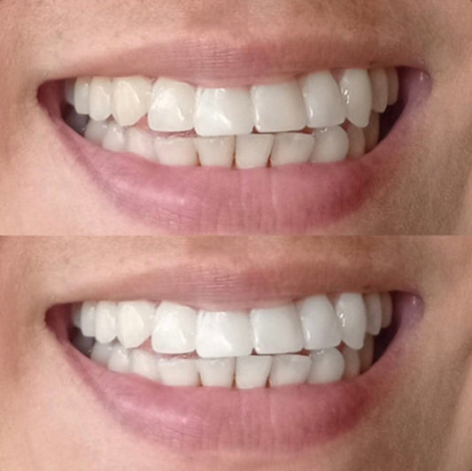 Nu Skin AP 24 Whitening Fluoride Toothpaste smile