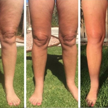 Nu Skin AgeLOC Dermatic Effects Before After 3