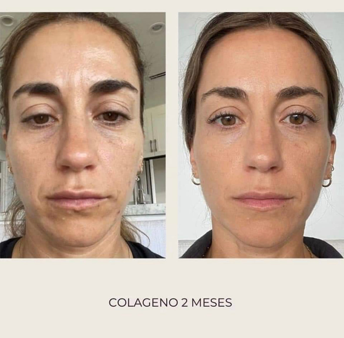Nu Skin Beauty Focus Collagen - Before and After