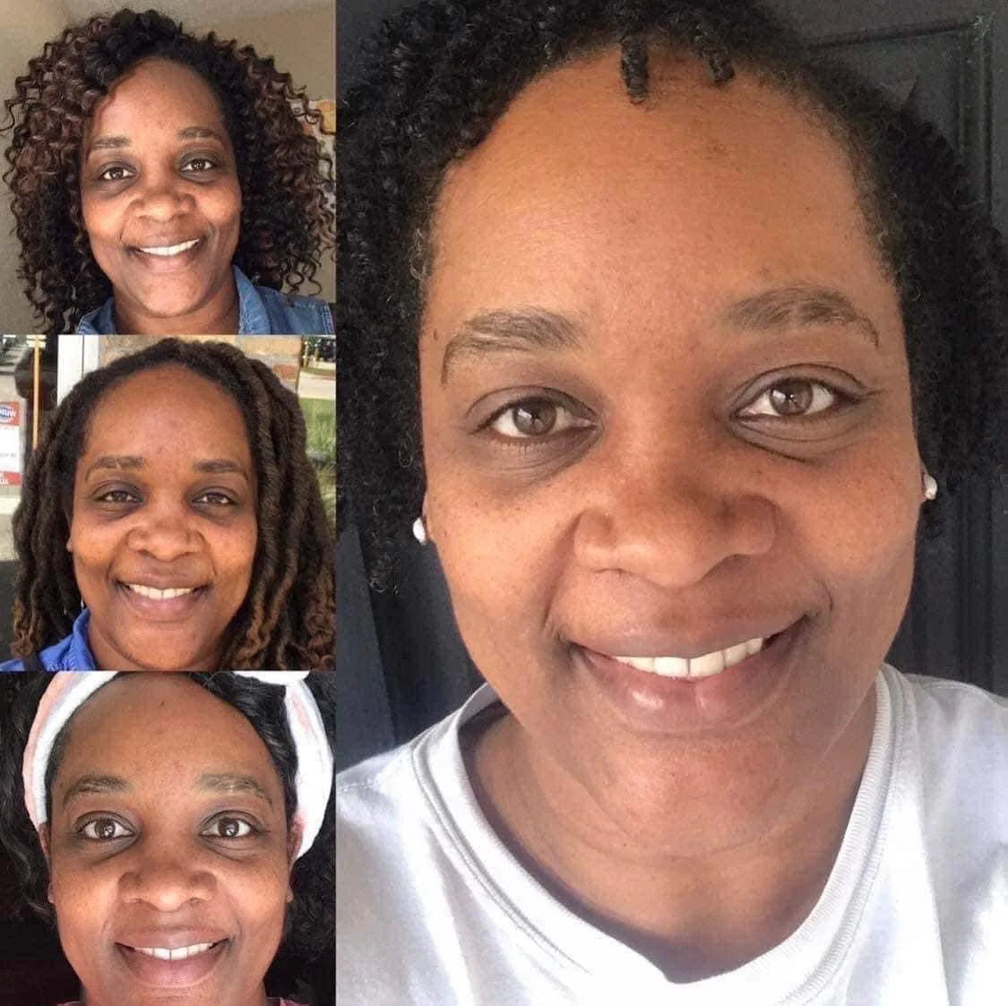 Nu Skin Collagen Results Before And After 11