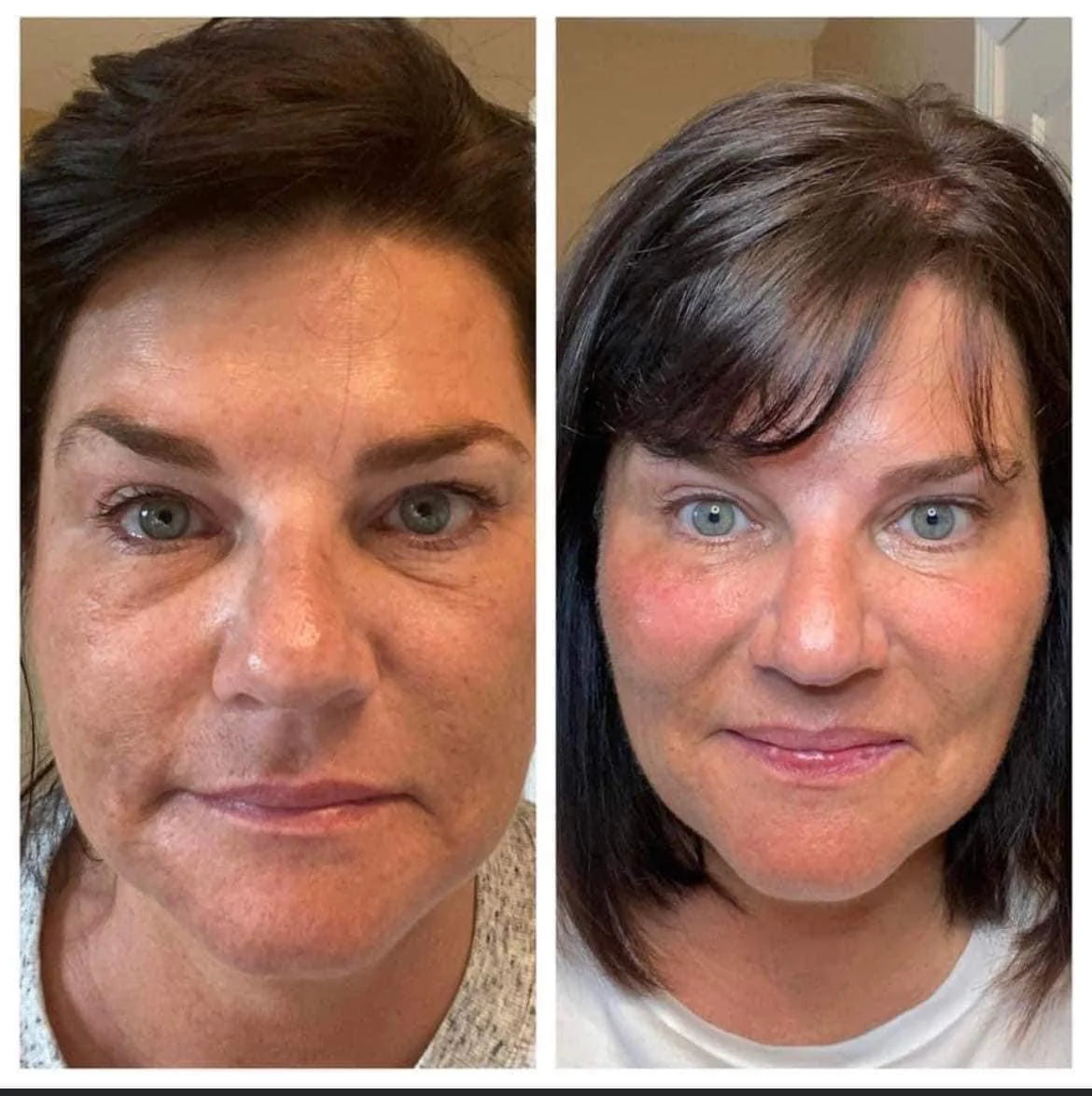 Nu Skin Collagen Results Before And After 12
