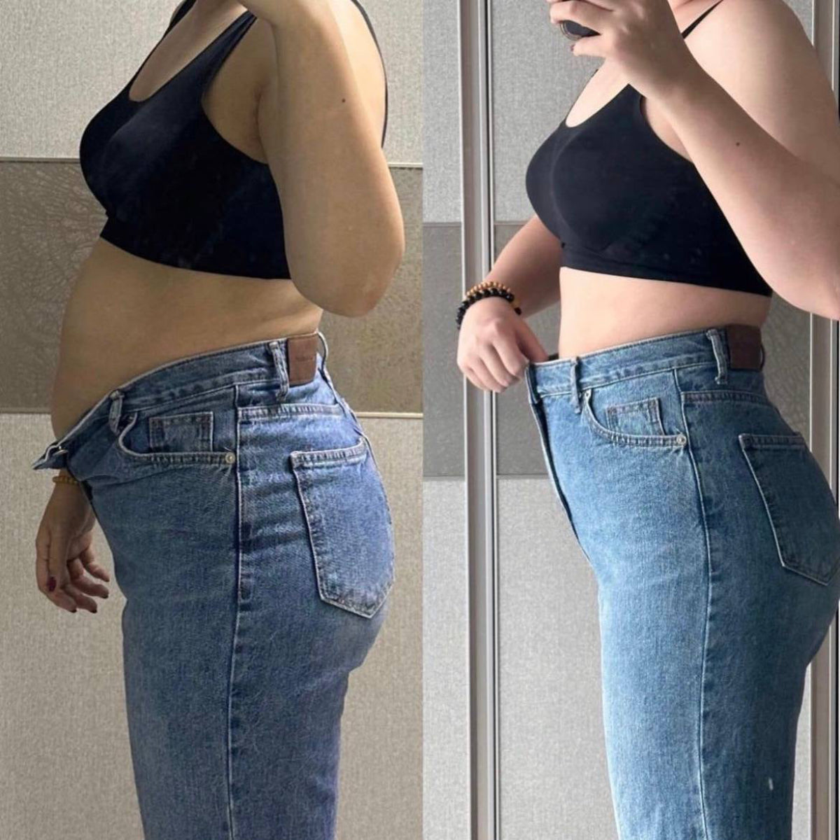 TRME Before And After