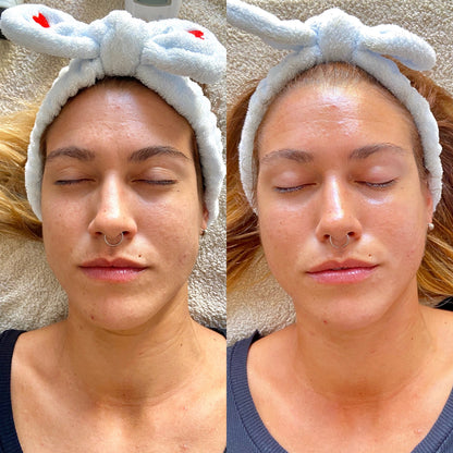Nu Skin ageLOC Galvanic Spa Facial Results