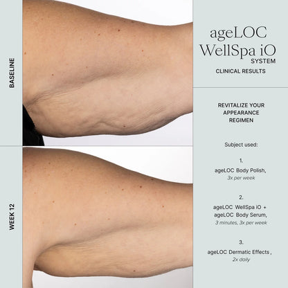 Nu Skin ageLOC WellSpa iO Before And After