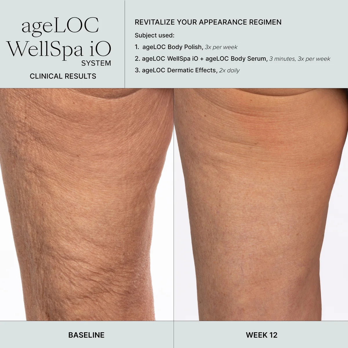 Nu Skin ageLOC WellSpa iO Before And After