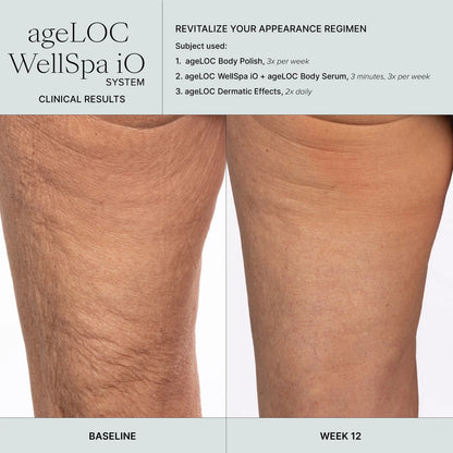 Nu Skin ageLOC WellSpa iO Before And After