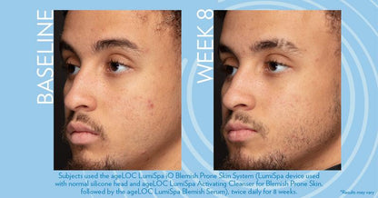 ageLOC LumiSpa Blemish Serum