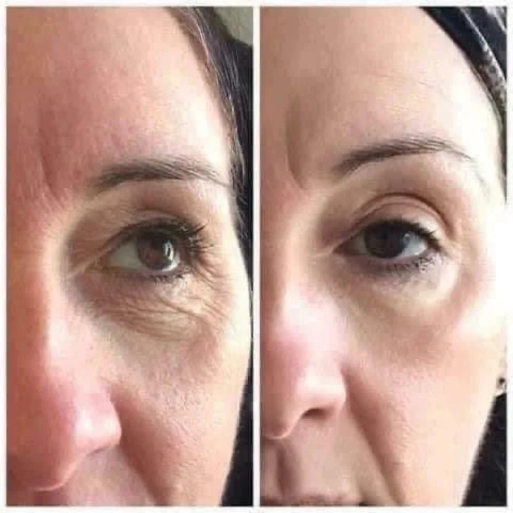 Side-by-side comparison of a woman's eye before and after tru face essence ultra