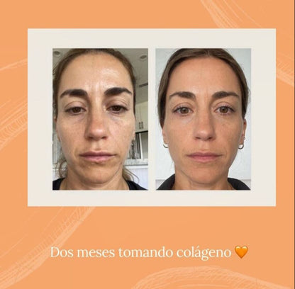 Beauty Focus Collagen - Colágeno de enfoque de belleza