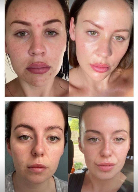 Nu Skin Lumispa IO Rose Gold avec un choix de nettoyant gratuit