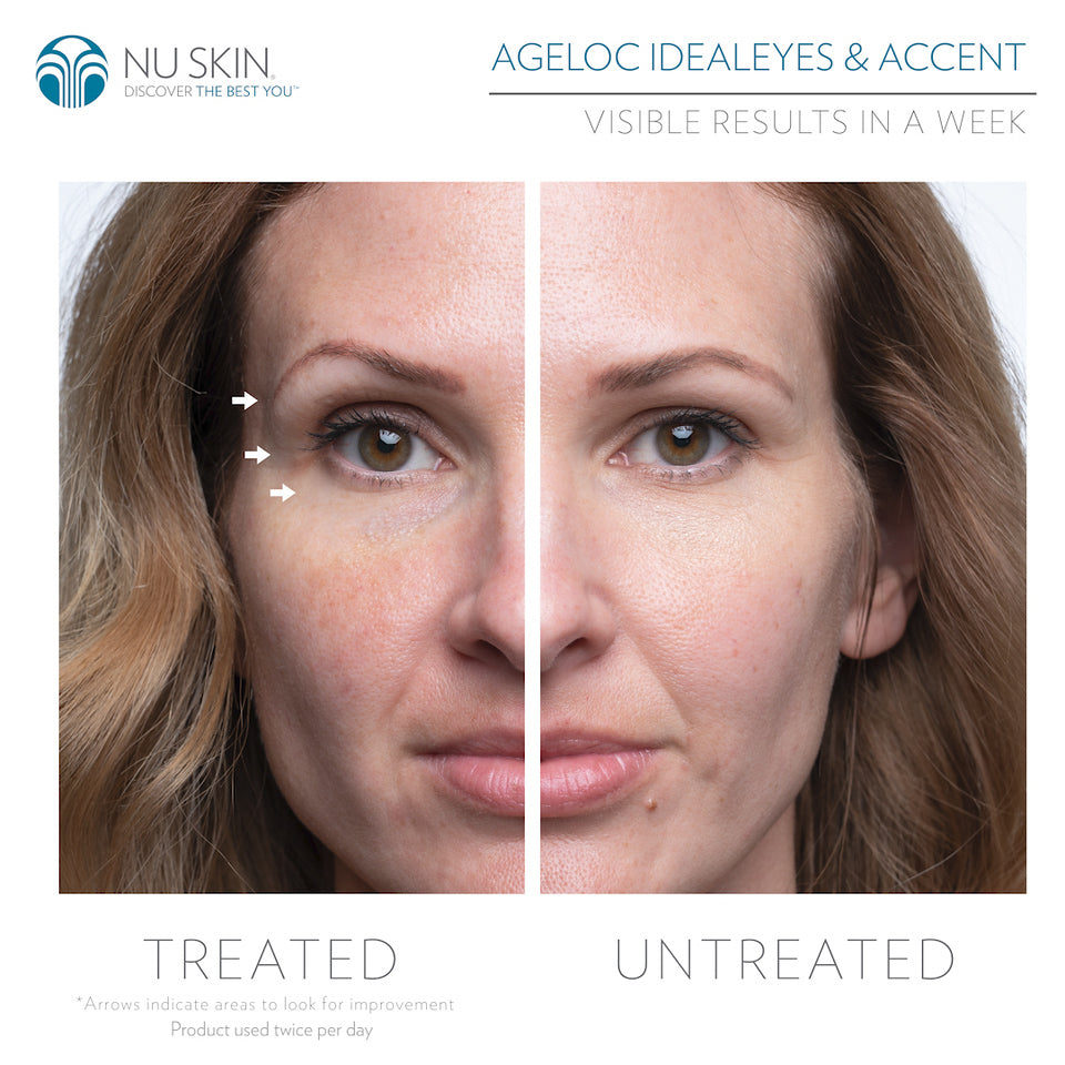 ageLOC Rose Gold LumiSpa® iO & Accent Head Bundle