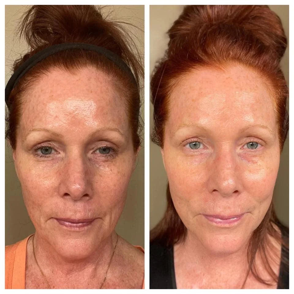 Nu Skin Collagen Before After Results woman red hair 