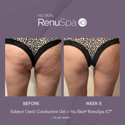 Nu Skin RenuSpa iO Kit