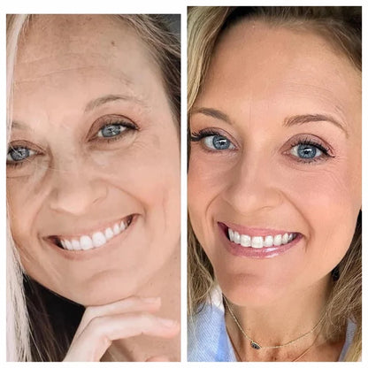 Before and after comparison of a woman's face with visible skin improvement.