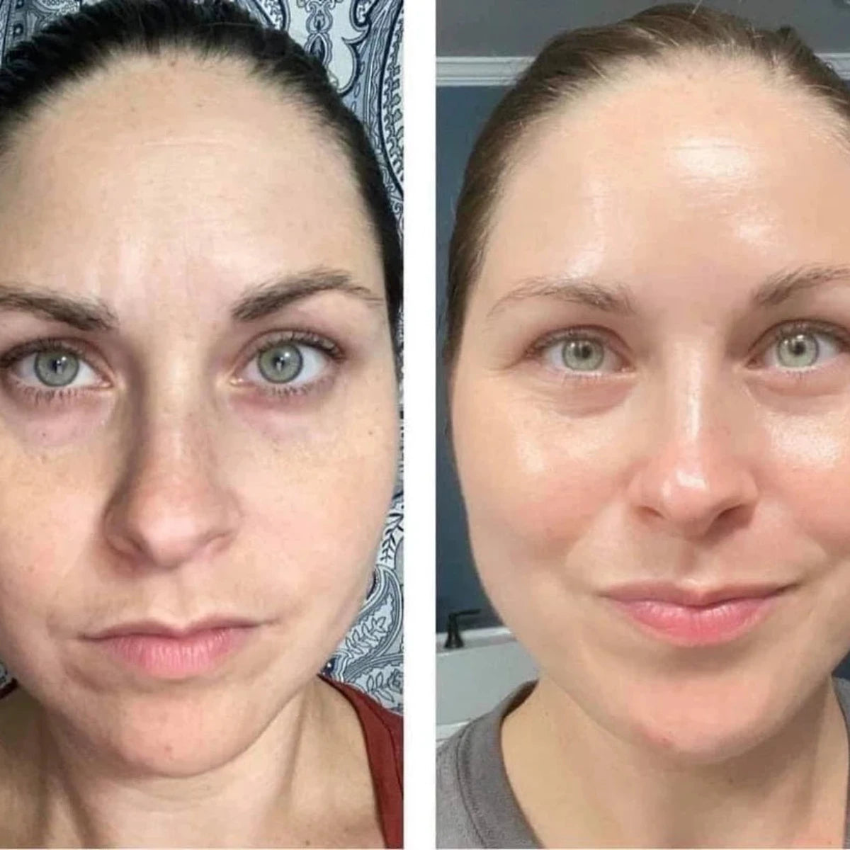 Before and after comparison of a woman's face with a neutral expression.