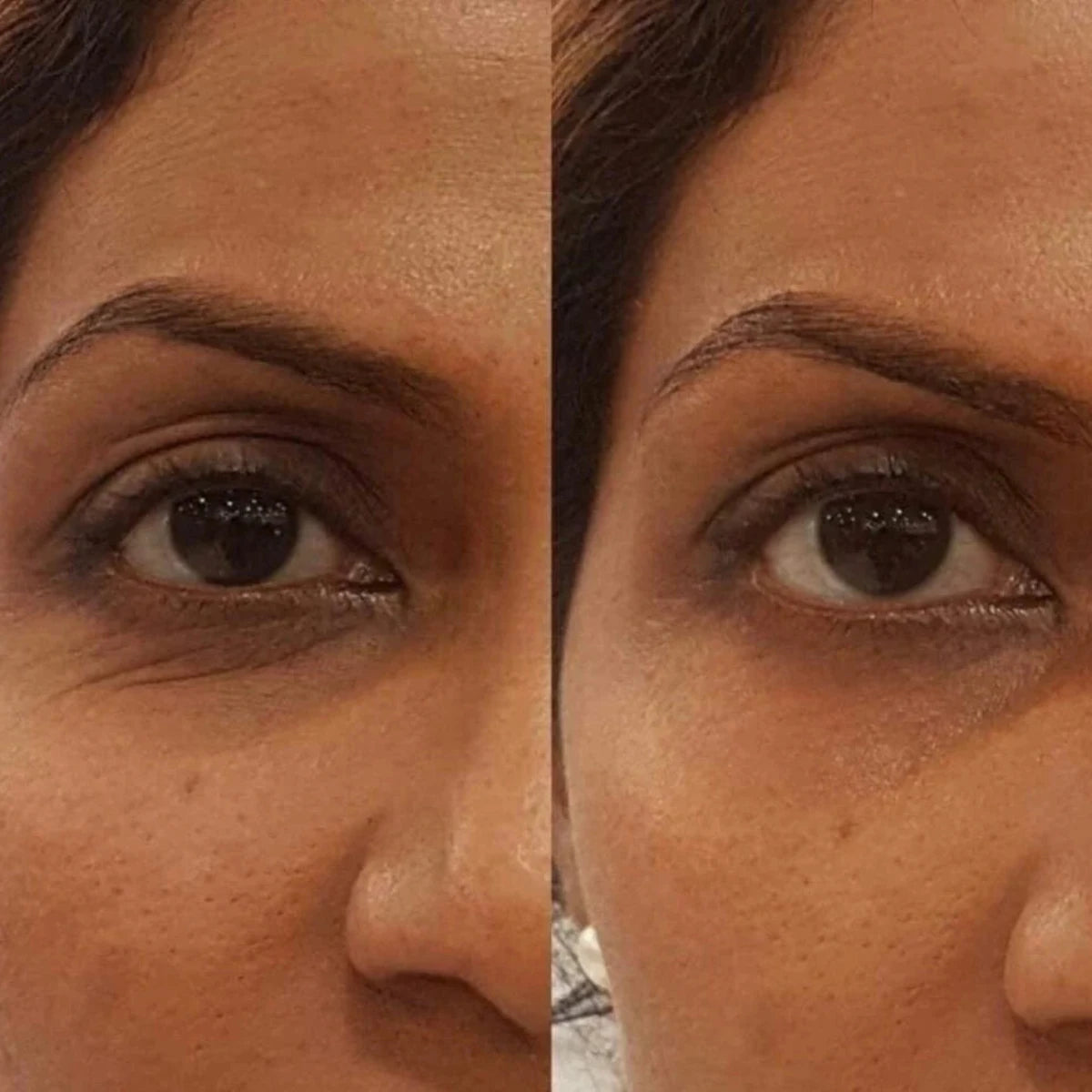 Side-by-side comparison of a woman's face with and without lumispa on the left eye.