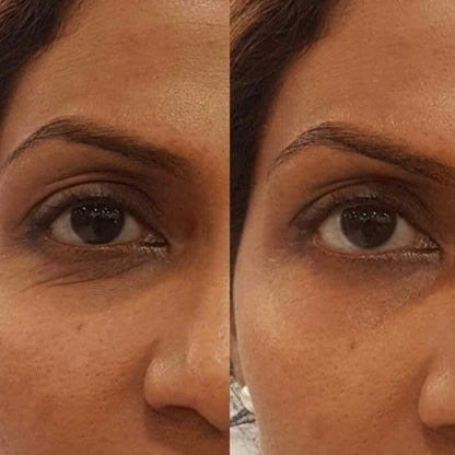 Side-by-side comparison of a woman's face with and without lumispa on the left eye.