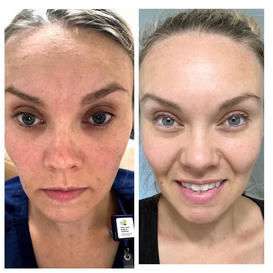 Nu Skin LumiSpa Rose Gold Beauty Device + Collagen+ Bundle
