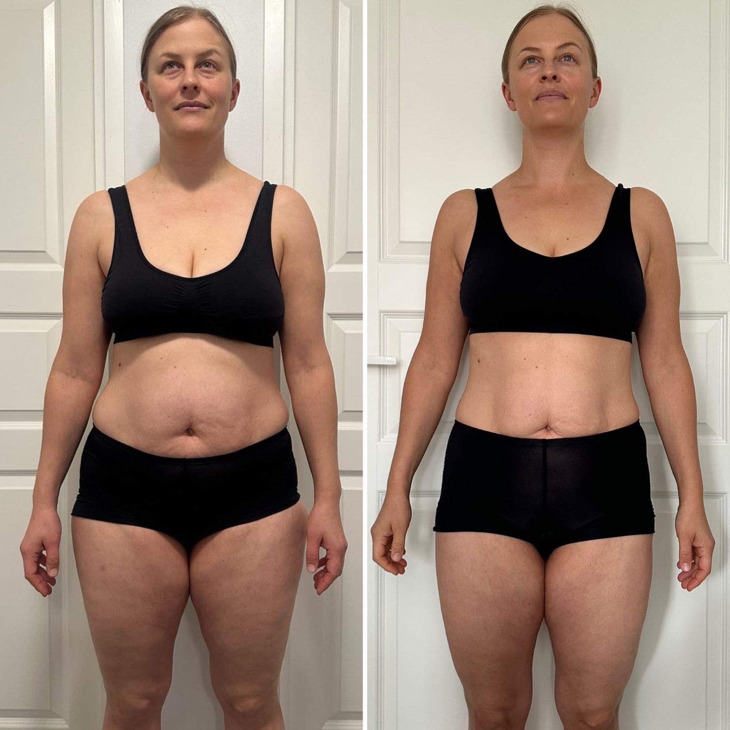 Ibiza beauty Store TRME Results Before And After Review