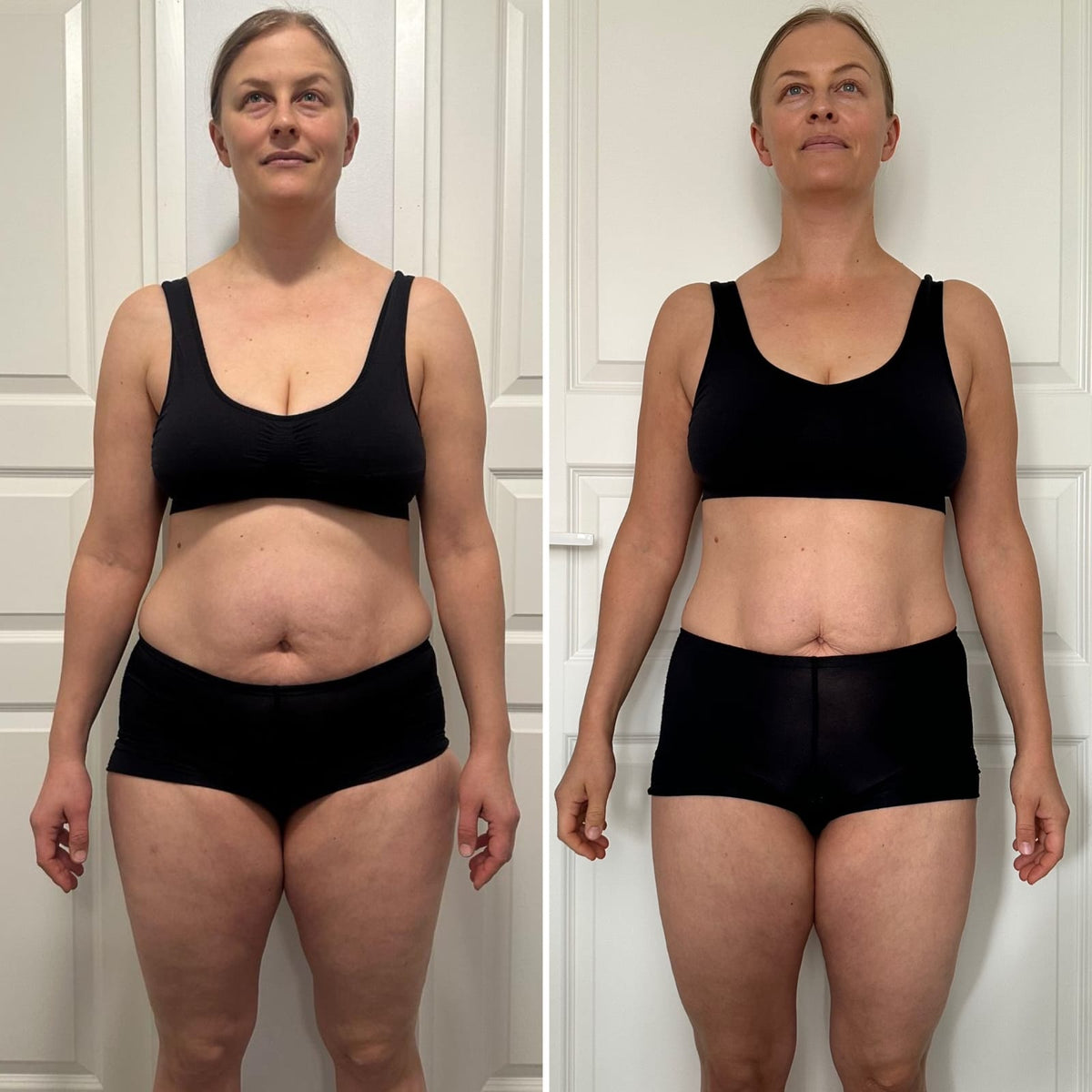 Nu Skin TRME Review | Honest Weight Loss Stories & Results – Ibiza ...