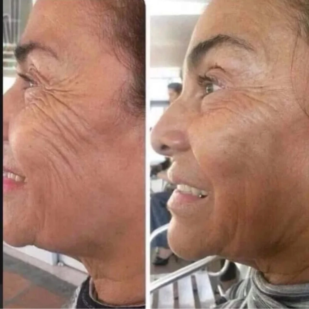 Side-by-side comparison of an elderly woman's face before and after try face essence ultra